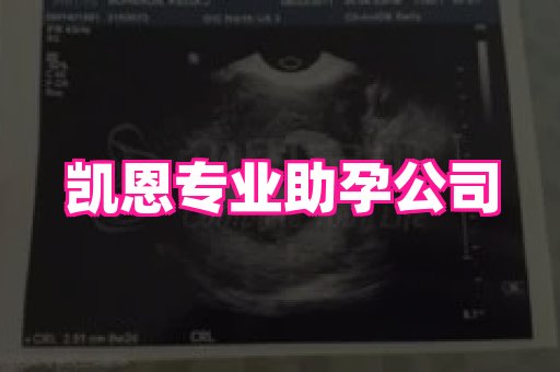 长春助孕网 4